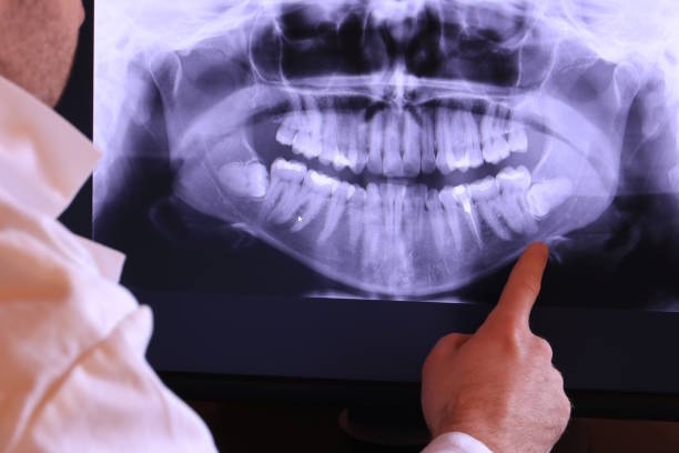 Best Emergency Tooth Extraction in George Mason, VA