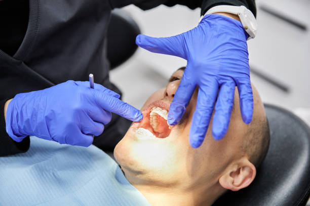 Best Emergency Broken Tooth Repair in George Mason, VA